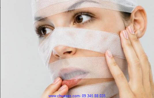 Sẹo làm ta thiếu tự tin Sẹo làm ta thiếu tự tin