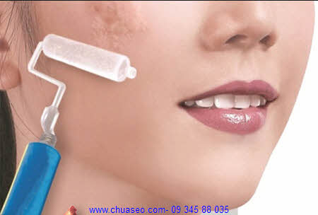 Khi vết thương đã lên da non bạn hãy sớm chăm sóc quan tâm đến việc trị sẹo cho da Khi vết thương đã lên da non bạn hãy sớm chăm sóc quan tâm đến việc trị sẹo cho da