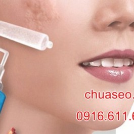 Cách chữa trị sẹo lồi tại nhà mà không cần đến thẩm mỹ viện