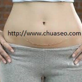 Ngăn chặn tấn công của tên sẹo lồi đáng ghét