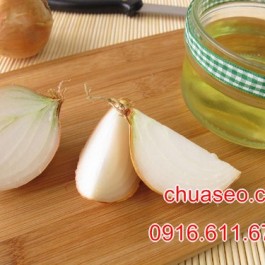 6 cách trị sẹo lồi tự nhiên đơn giản mà cực kỳ hiệu quả